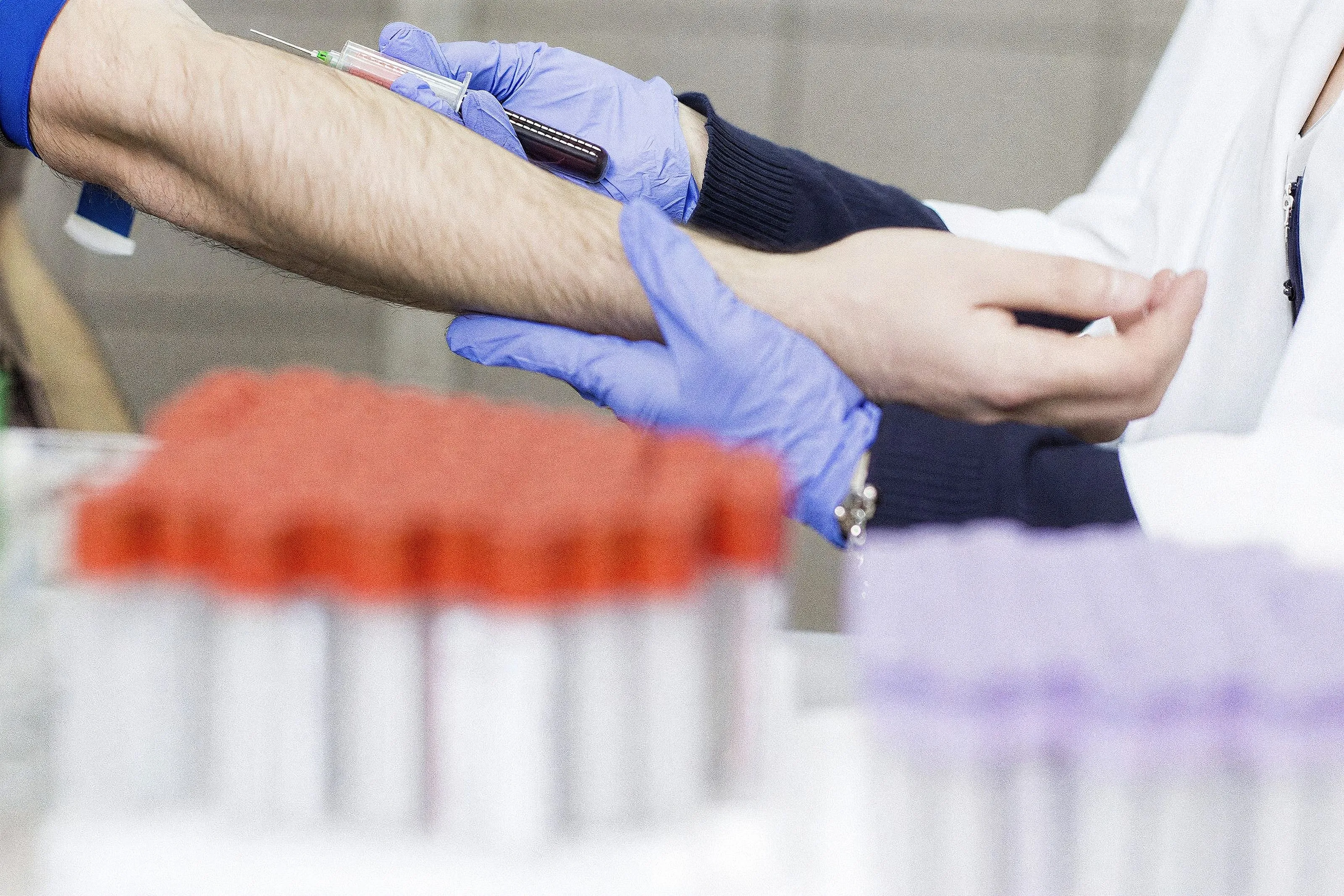 Primer plano de unas manos con guantes azules que extraen sangre del brazo de un voluntario con una jeringa; delante, desenfocados, tubos de muestras con tapón rojo y lila.