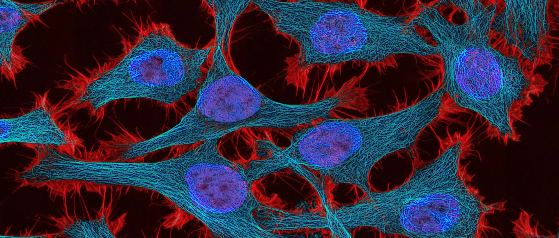 Imagen de microscopía de fluorescencia de un grupo de células: los núcleos en azul violeta, el citoesqueleto en una red de filamentos turquesa y los bordes de cada célula en rojo sobre fondo oscuro.